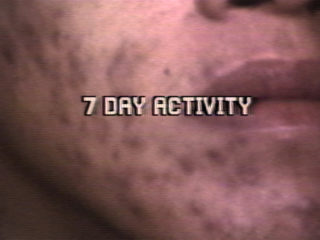 7 DAY ACTIVITY